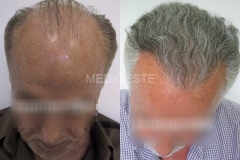 before-after-15