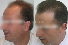 before-after-16