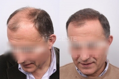 before-after-18