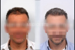 before-after-2-1