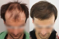 before-after-22