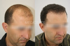 before-after-23