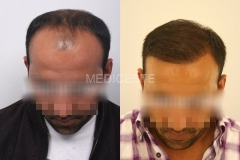 before-after-24