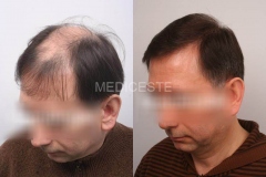 before-after-27