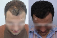 before-after-28