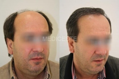 before-after-9-1